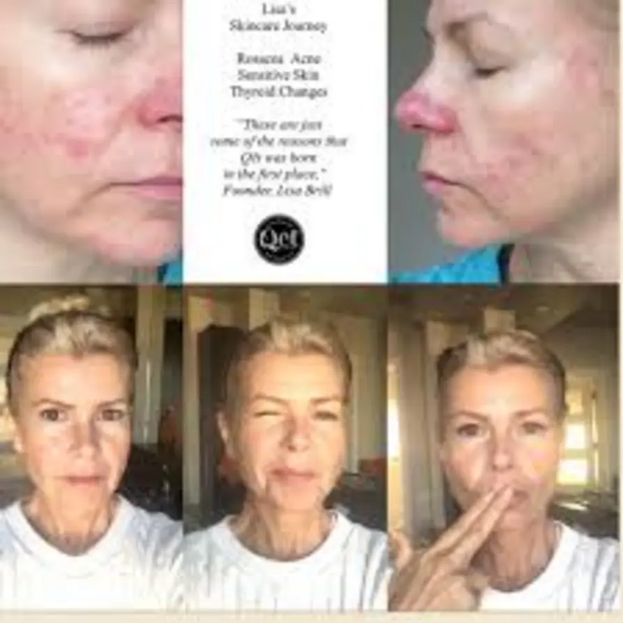Side by side skincare results