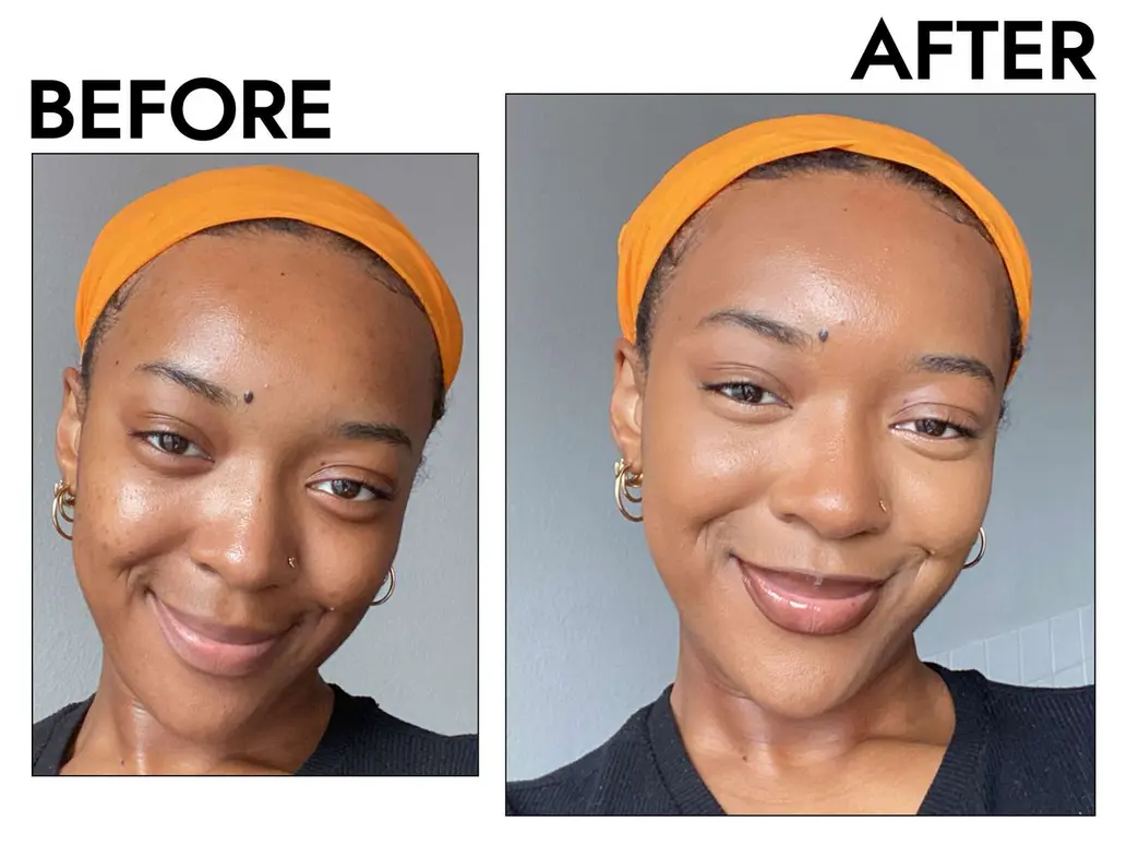 Face before and after serum use
